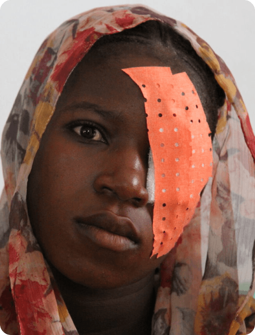 Eye care for a patient in Mali