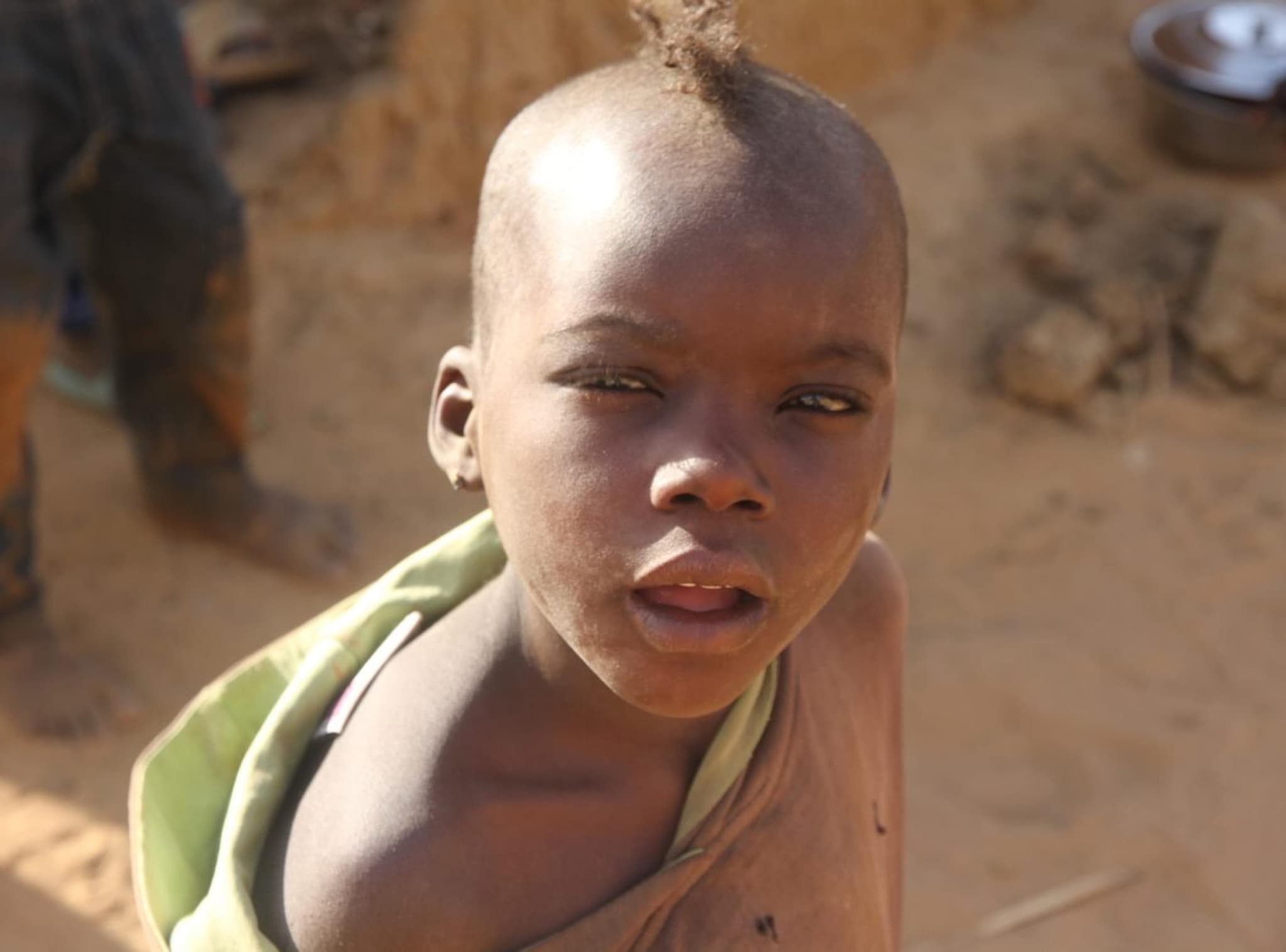 A child supported by Muntada Aid's Feed the Forgotten appeal