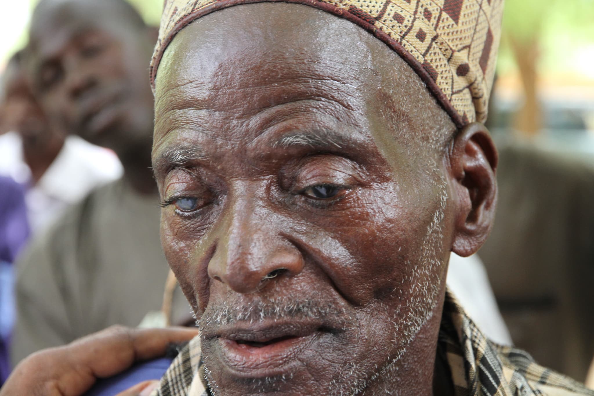 A cataract surgery patient supported by Muntada Aid in Niger